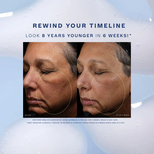 Skinbeam Milky Serum